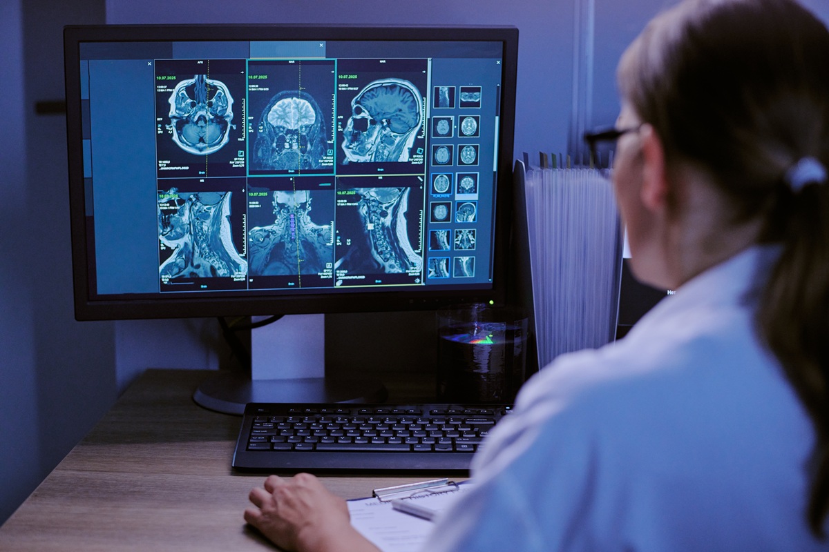 Un estudio con 13 pacientes reduce 80% las falsas alarmas de un monitor de epilepsia Un estudio con 13 pacientes reduce 80% las falsas alarmas de un monitor de epilepsia